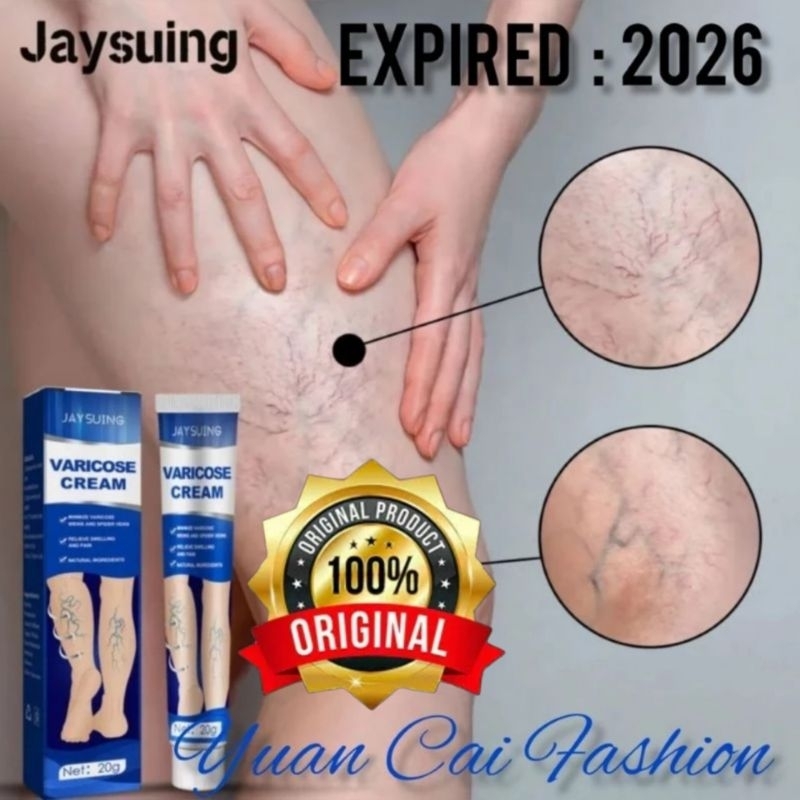 JAYSUING, 20G Krim Varises, EXP : 2026 Krim Kaki Menenangkan Varises Vena Alami Pengobatan Varises &