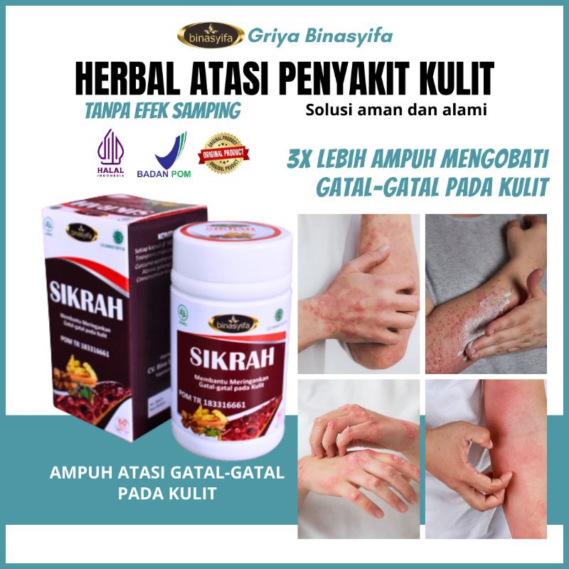 Obat Gatal Biduran Dewasa Anak Herbal Binasyifa