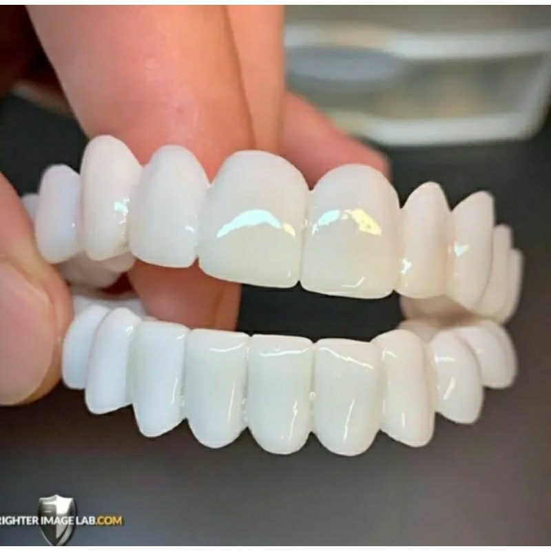 COD GIGI PALSU INSTAN UDAH SATU SET ATAS BAWA ORIGINAL TINGGAL PASANG SENDIRI BISA BUWAT MAKAN.