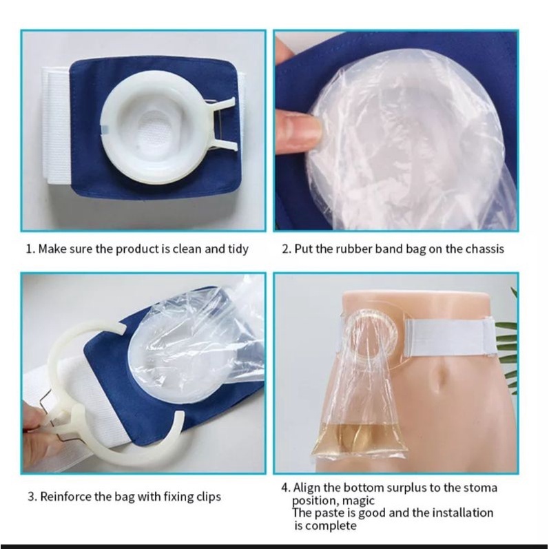 Colostomy Bag Adjustable Sabuk Kolostomi Ostomy Bag Kantong Kolostomi Kantong Stoma Dewasa Colostomy Bag