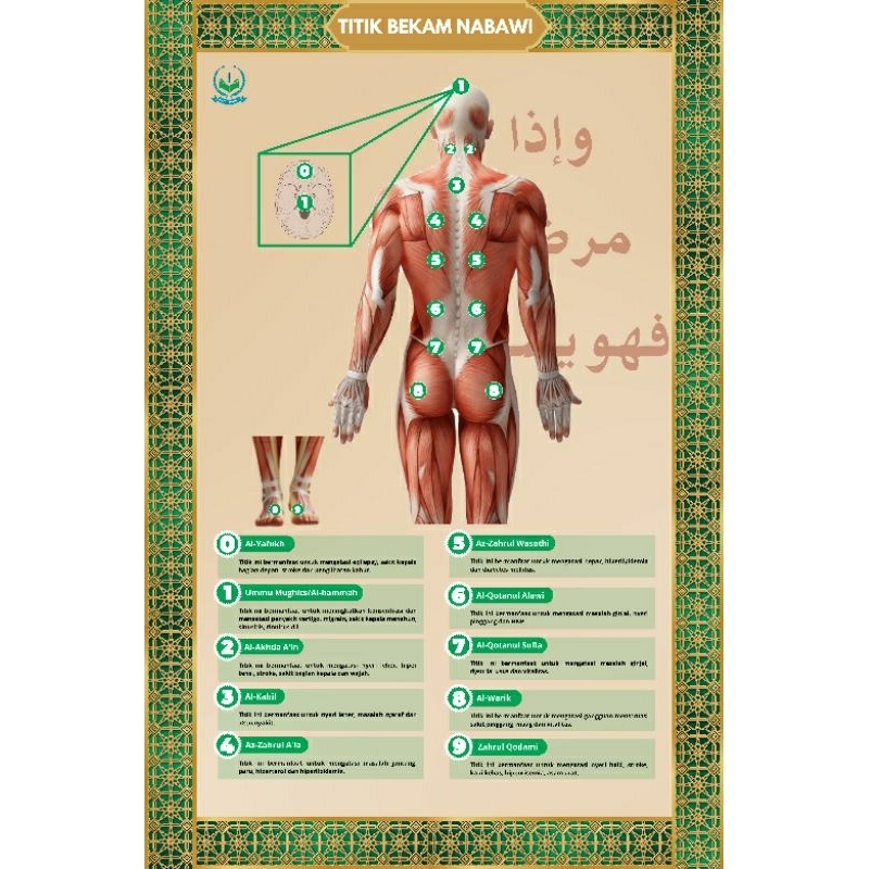 Poster Titik Bekam/Hijamah Nabawi