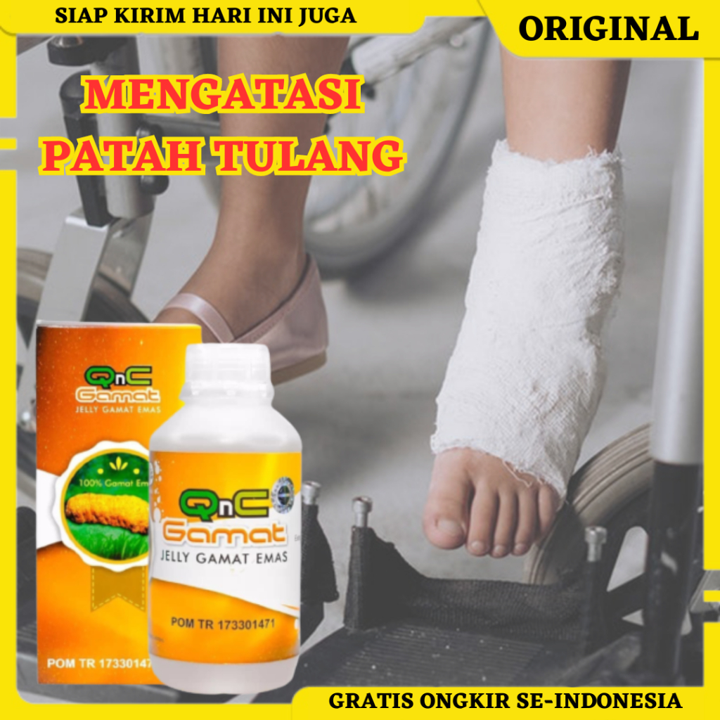 QnC Jelly Gamat, Obat Patah Tulang, Obat Tulang Retak, Obat Patah Tulang Kaki, Obat Patah Tulang Tan