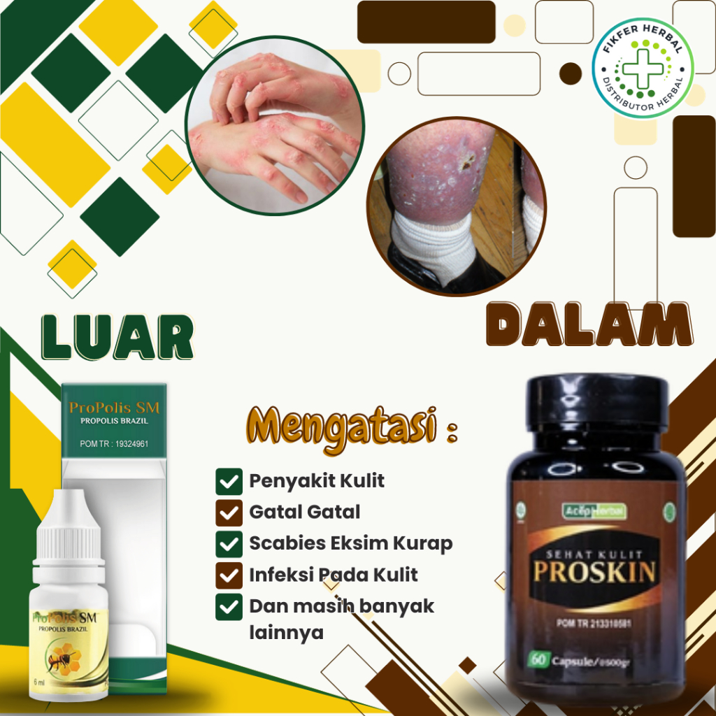 Obat Gatal - Gatal, Obat Penyakit Kulit, Obat Scabies, Eksim, Obat Kulit Berjamur, Obat Infeksi Kuli