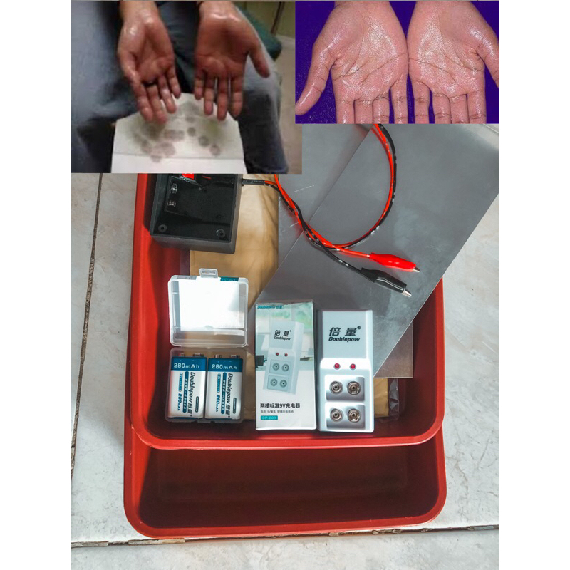 Alat terapi keringat berlebih/iontophoresis hiperhidrosis