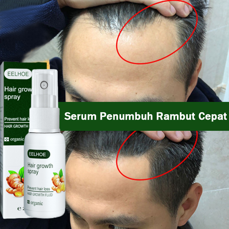 GINGER HAIR HEALTH SPRAY/ EELHOE HAIR SPRAY/ Hair growth serum spray Anti tonik rambut rontok