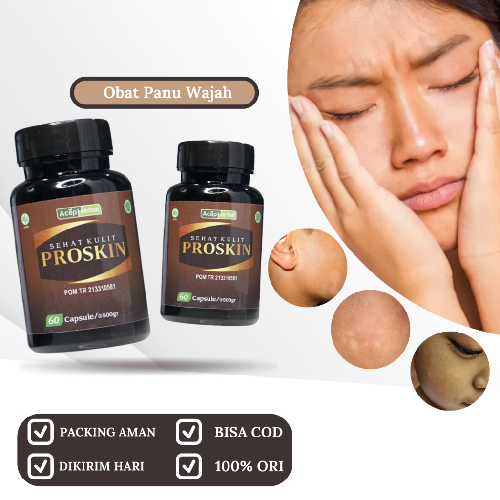 PROSKIN 100% ORIGINAL BPOM, Obat Balas Bogo, Obat Penghilang Hapur Besi, Obat Penghilang Bercak Puti