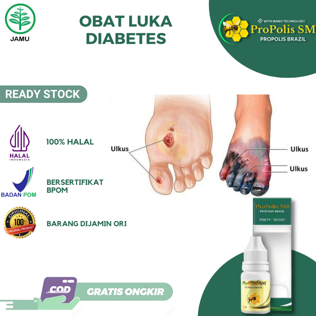 Obat Luka Diabetes, Obat Luka Diabetes Basah, Obat Luka Diabetes Kering, Obat Luka diabetes Bernanah