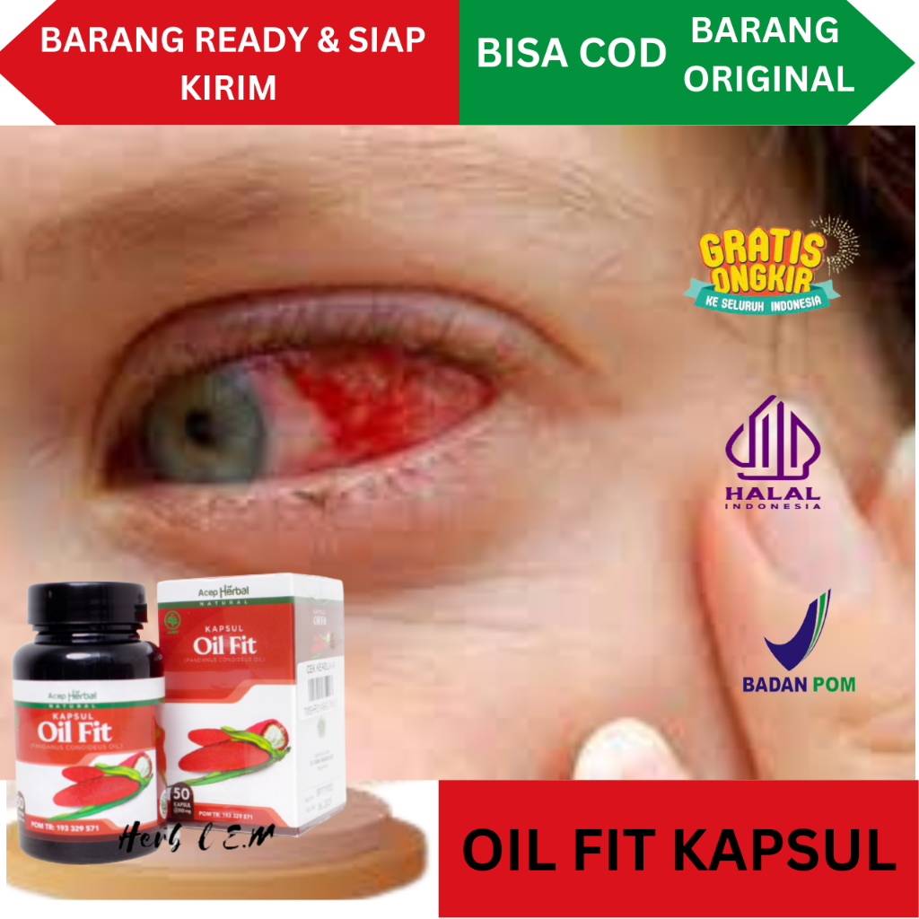 Obat Mata Merah Dan Perih Obat Sakit Mata Obat Infeksi Mata Merah Obat Iritasi Mata Obat Mata Bengka