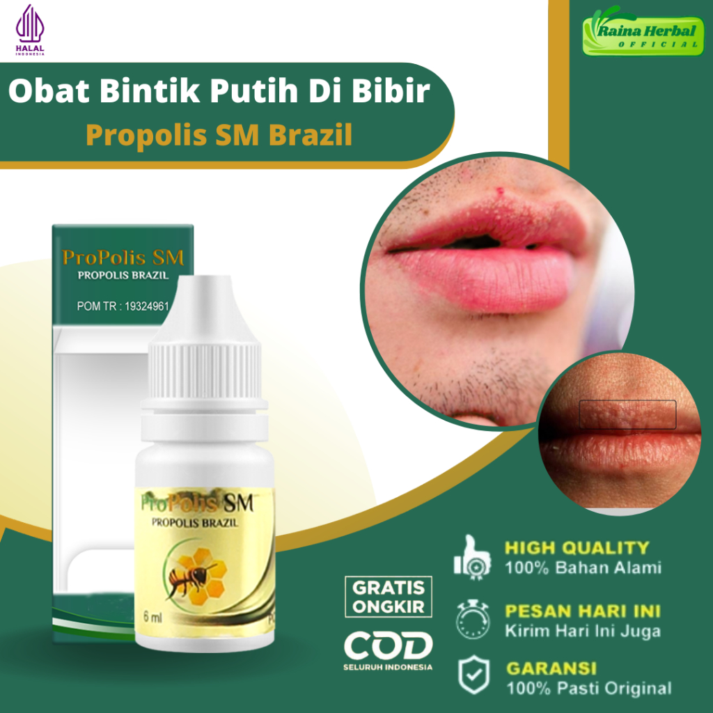 Obat Penghilang Bintik Putih Di Bibir, Obat Oles Bintik Putih Di Bibir, Obat Fordyce Spots / Bintik 