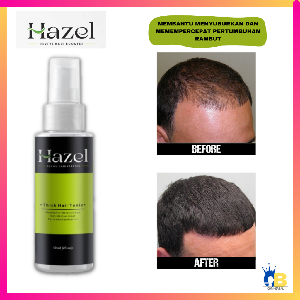 Hazel Hair Tonic Penumbuh Rambut Alami 60 ml