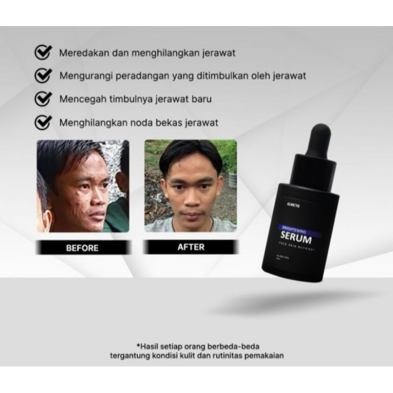Elvicto Brightening Serum 30ml / Serum elvicto / Elvicto serum