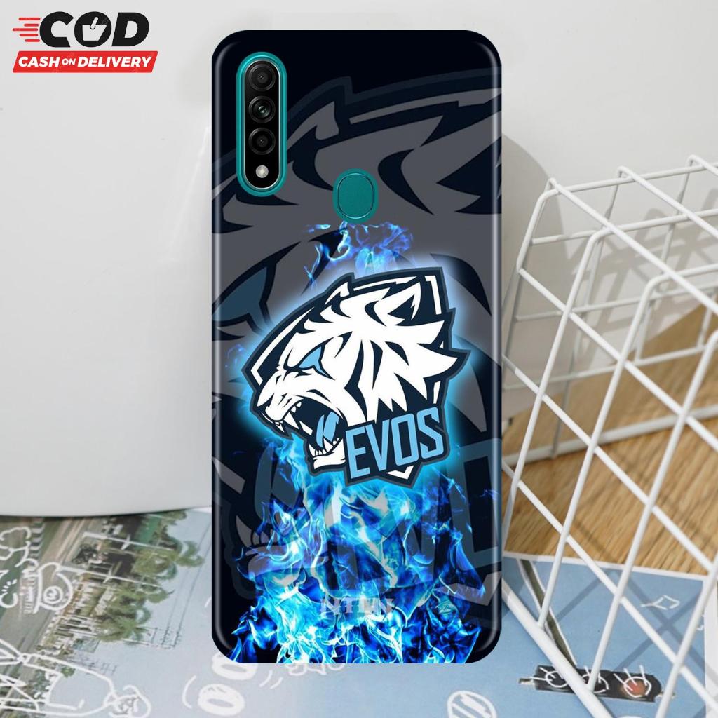 Case OPPO A31 - Casing Hp - Softcase Case OPPO OPPO A31 - Casing Hp - Softcase - Case HP OPPO  OPPO 