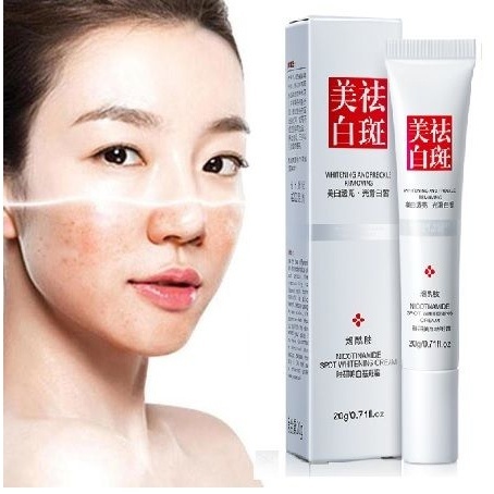 Cream Whitening Freckle Cream Remove Dark Spots Anti Freckle Cream Niacinamide Fade Pigmentation Mel