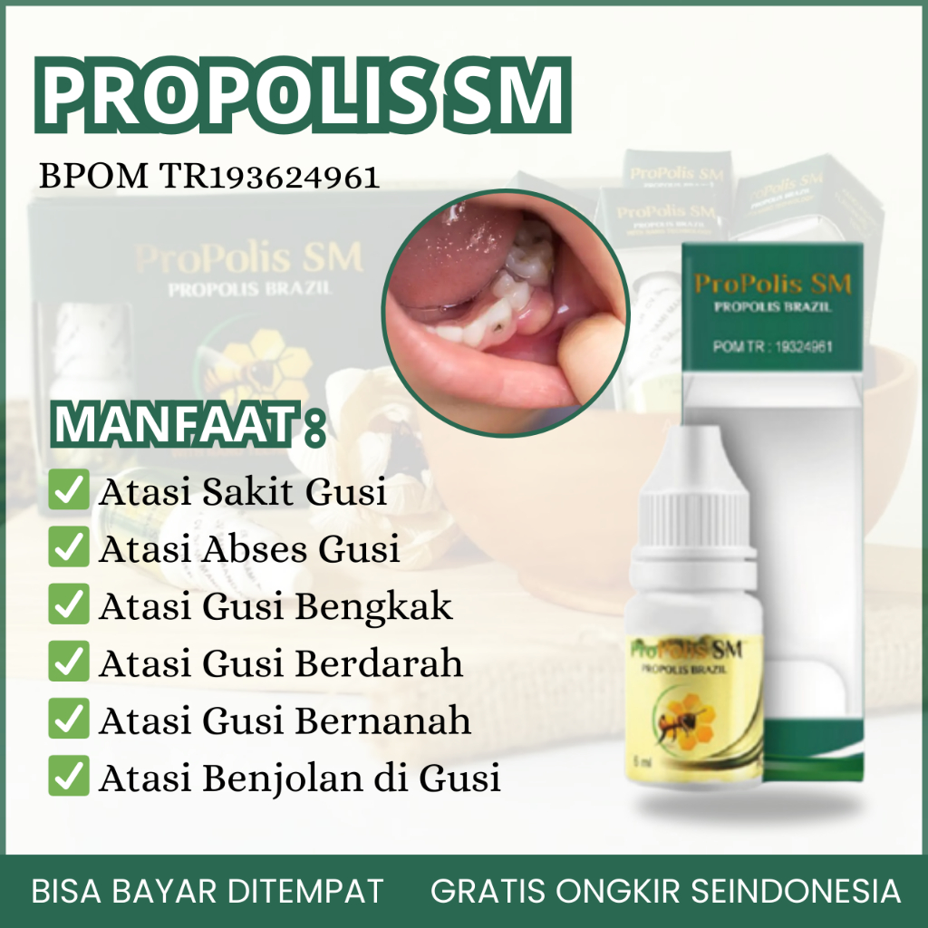 Obat Gusi Bengkak, Obat Sakit Gusi, Obat Gusi Berdarah, Obat Gusi Bernanah, Obat Abses Gusi, Obat Gu