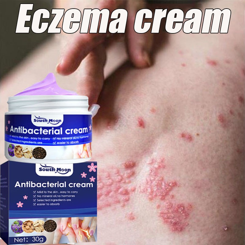 Salep gatal salep jamur kulit salep eksim Salep psoriasis Cepat dan efektif Obat Gatal Pantat Dan Se