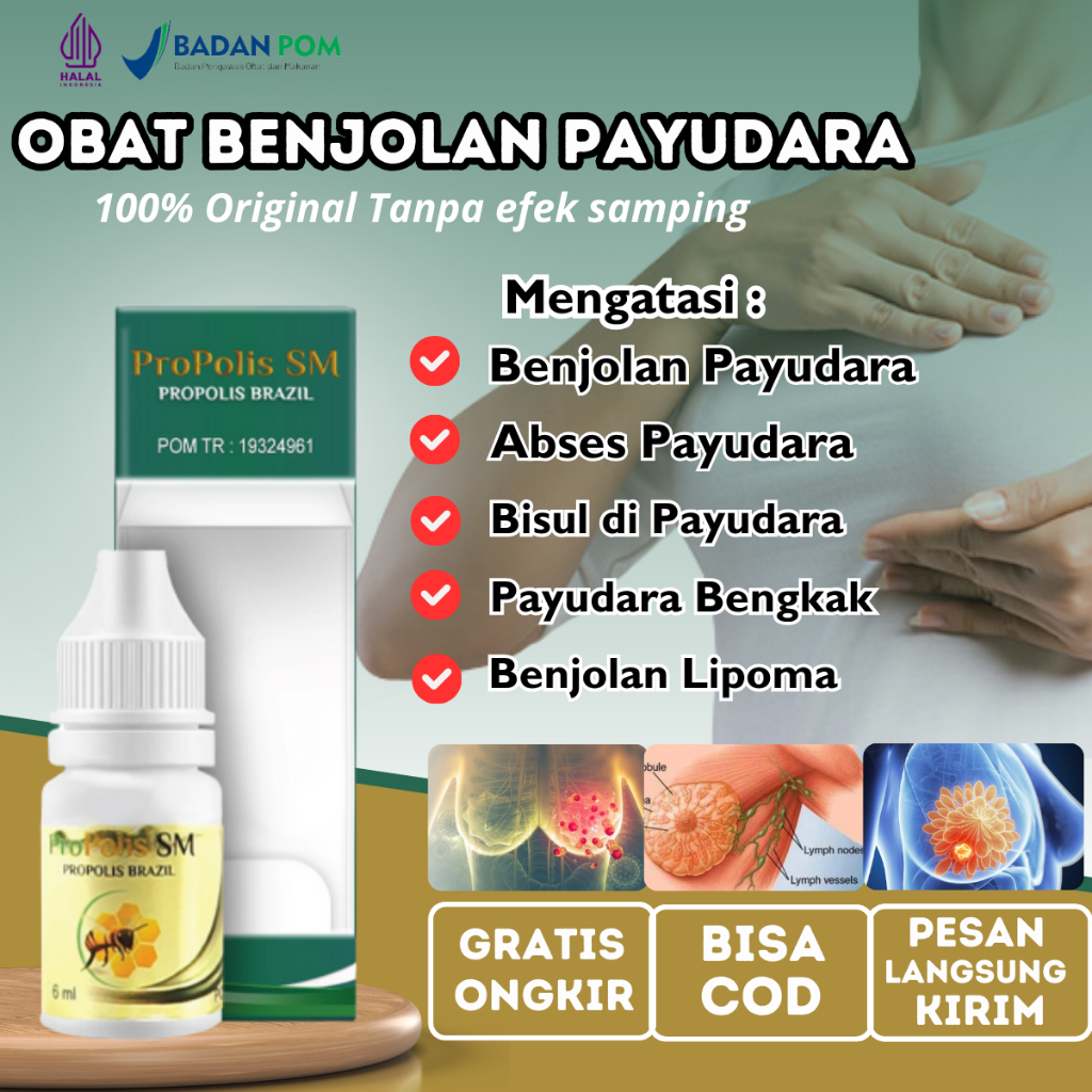 Obat Benjolan Lipoma Di Payudara, Obat Payudara Sakit Dan Bengkak, penghancur Kanker Tumor Benjolan 