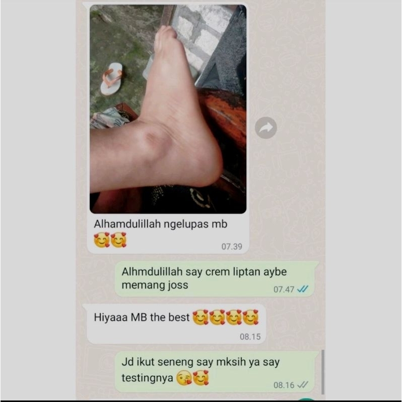 CREAM LIPATAN AYBE DIAMOND SKINCARE