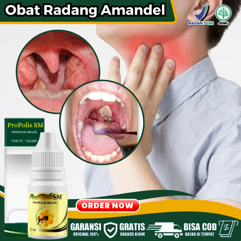 Obat Sakit Tenggorokan Nyeri Saat Menelan Makanan & Minuman Obat Amandel Bengkak Parah Radang Amande