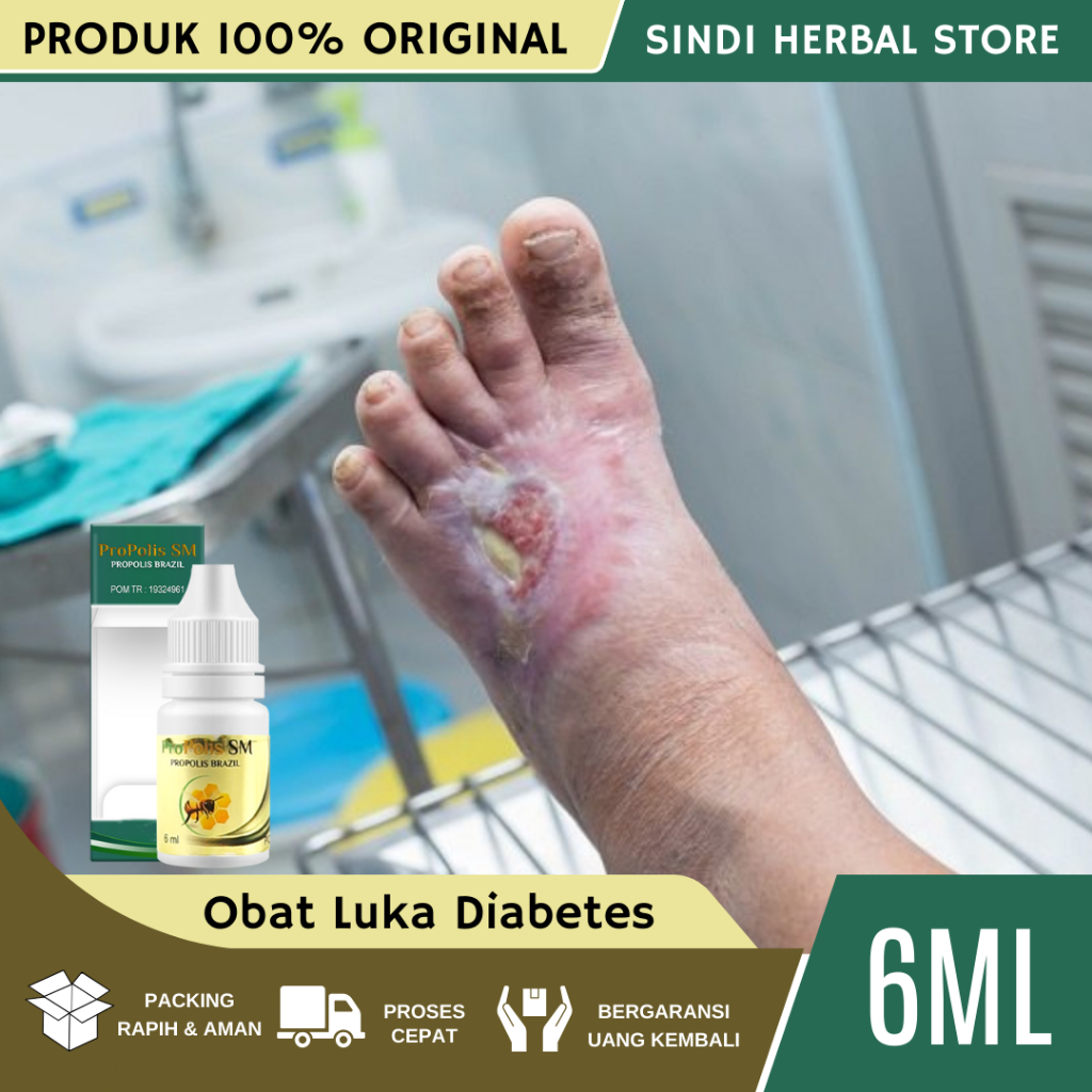 Obat Luka Diabetes Agar Cepat Kering, Obat Luka Diabetes Basah, Obat Luka Diabetes Cepat Kering, Oba