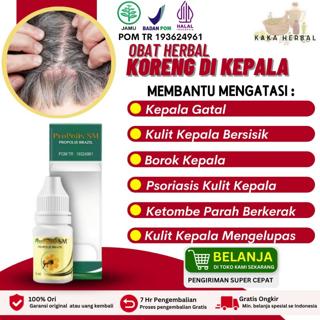 Obat Koreng Di Kepala Borok Bernanah di Kulit Kepala Psoriasis Kulit Bersisik Berkerak Kering Luka B