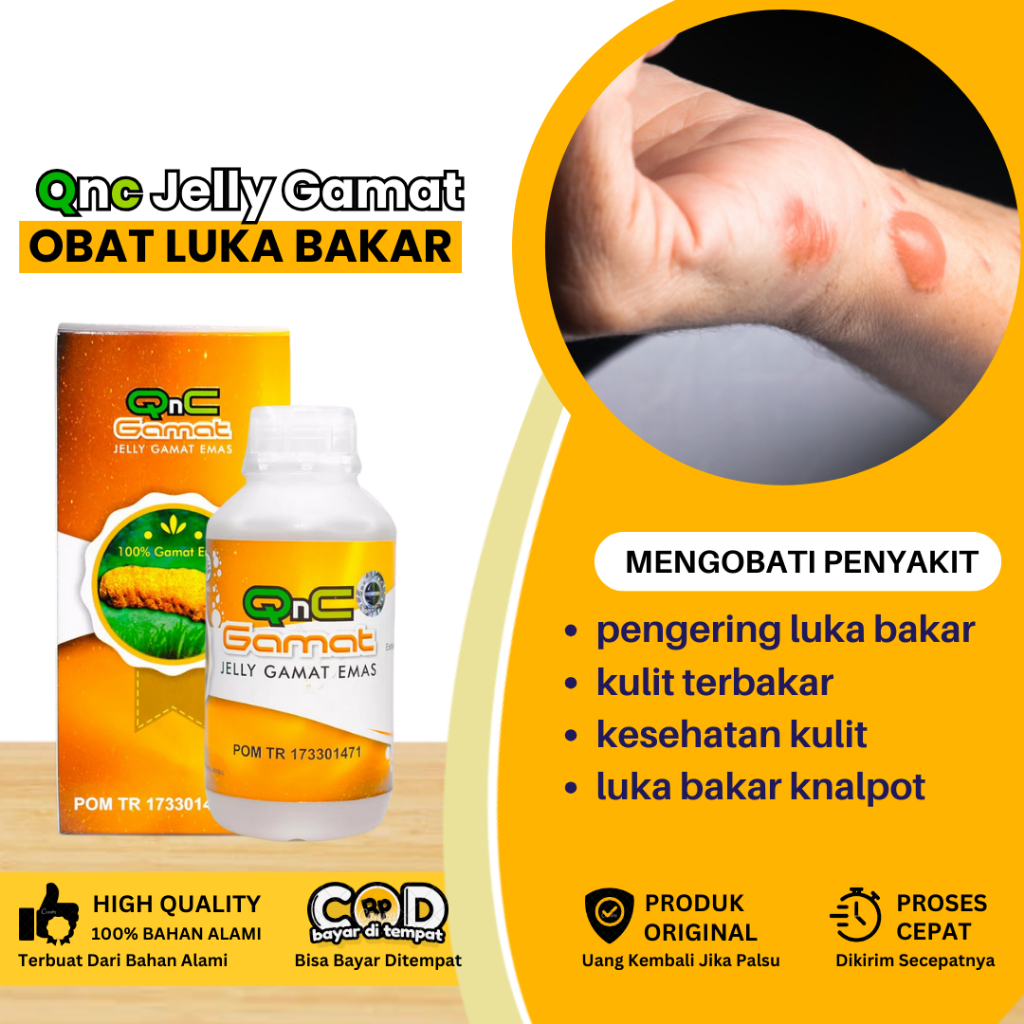 Obat Luka Bakar, Obat Untuk Luka Bakar, Obat Perawatan Luka Bakar, Obat Kulit Melepuh, Obat Kulit Te