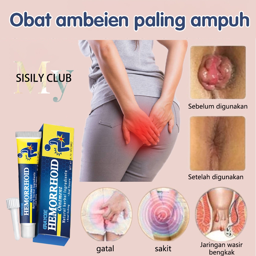 Krim Wasir 20g Menghilangkan Bola Daging Menghilangkan wasir internal dan eksternal Salep Menghilang