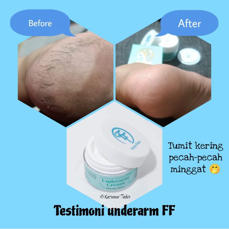 Underarm Cream FF Fenny Frans