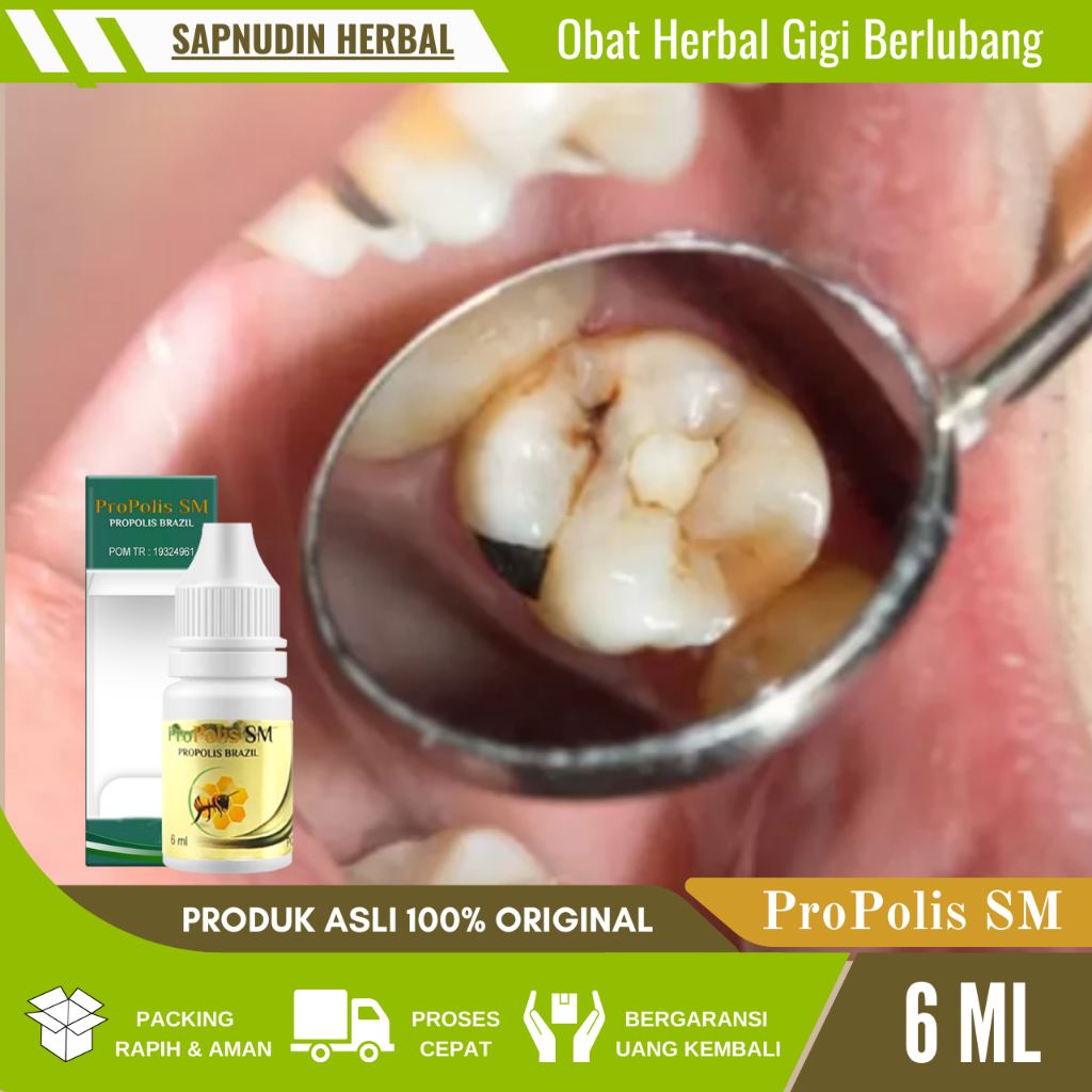 Obat Herbal Gigi Berlubang, Obat Permasalahan Gigi, Obat Tetes Sakit Gigi, Obat Gigi Berlubang Agar 