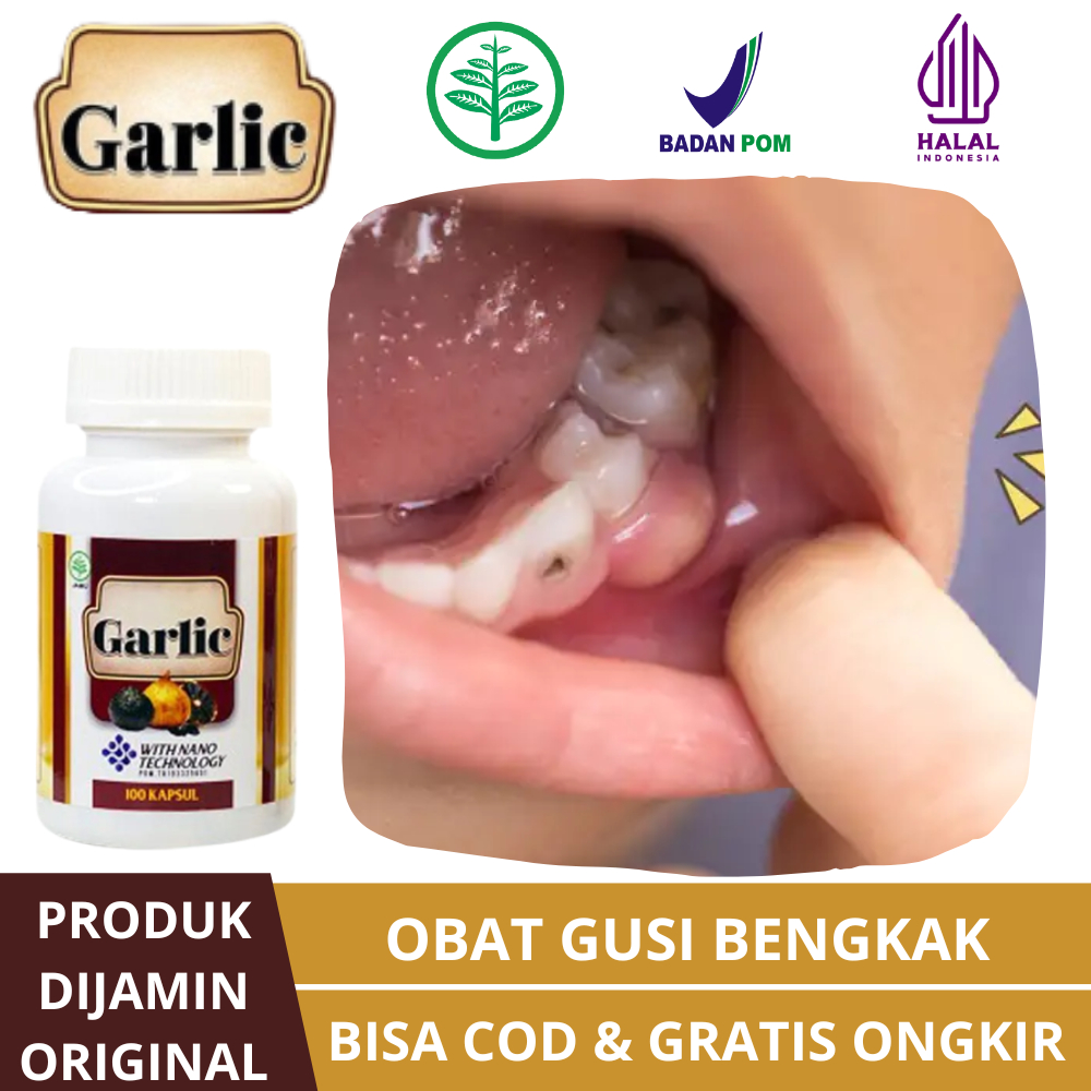 Obat Herbal Gusi Bengkak, Pengecil Benjolan Di Gusi Atas Bawah, Obat Radang Gusi, Sariawan Di Gusi, 