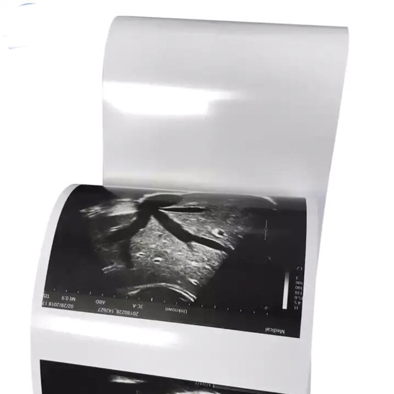 

H7Y Kertas USG Sony UPP 110HG Type V High Glossy