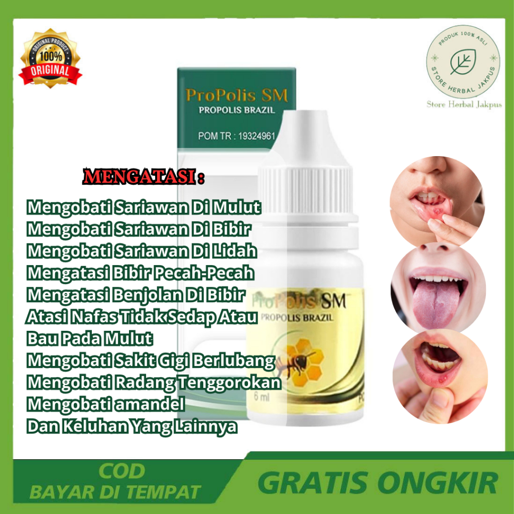 Obat Sariawan Akut - Sariawan Parah - Sariawan Berdarah - Sariawan Radang - Sariawan Menahun Supaya 