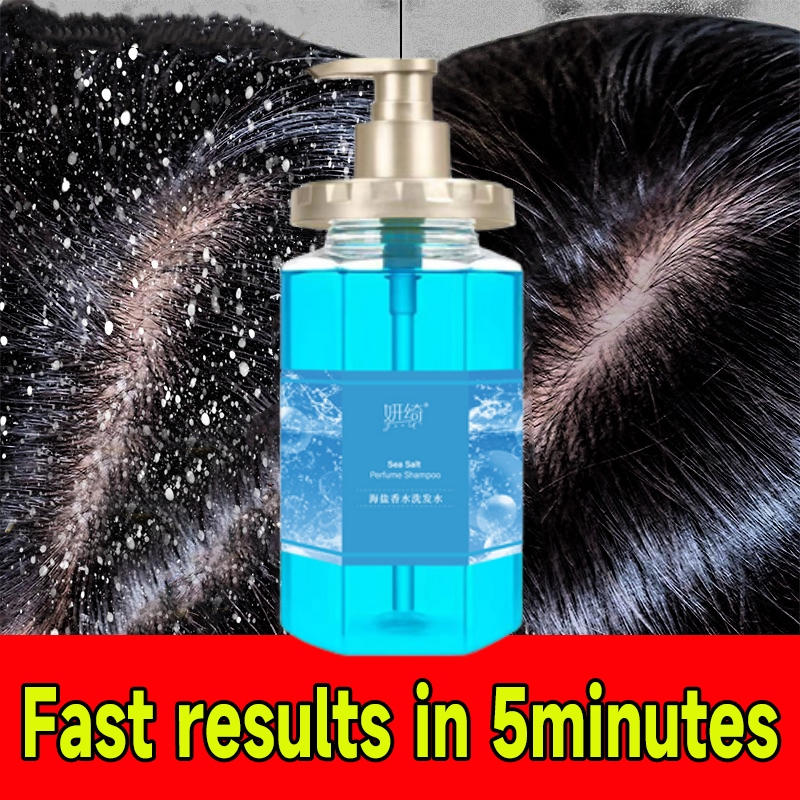 Shampo Anti Ketombe Dan Rambut Rontok Obat Ketombe Sampo Anti Ketombe Dan Gatal Shampo Psoriasis Men