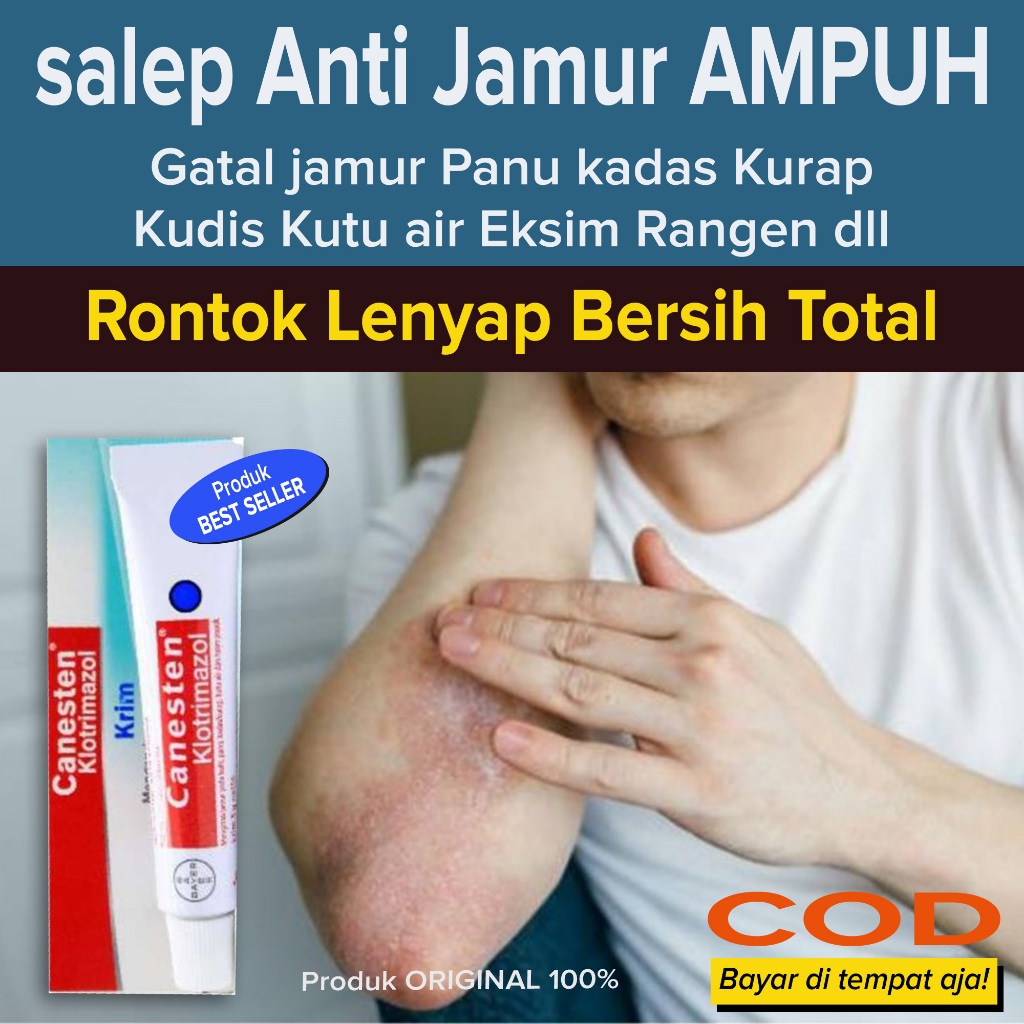 Best seller Salep obat Gatal anti jamur Membersihkan Memusnahkan Berbagai jenis gatal jamur dan Kuma