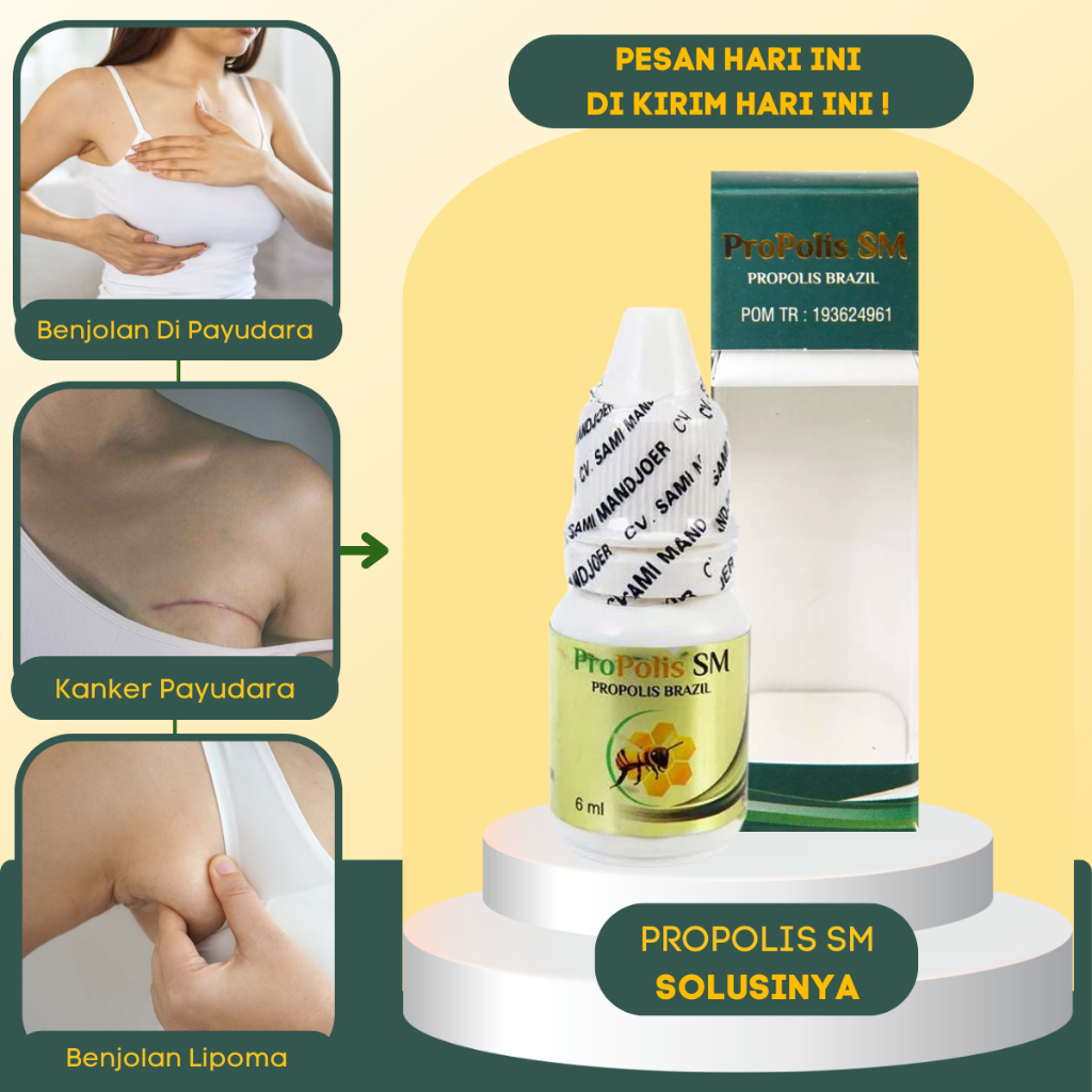 Obat Nyeri Payudara|Obat Benjolan di Payudara|Obat Payudara Bengkak|Obat Benjolan Lipoma di Ketiak|O