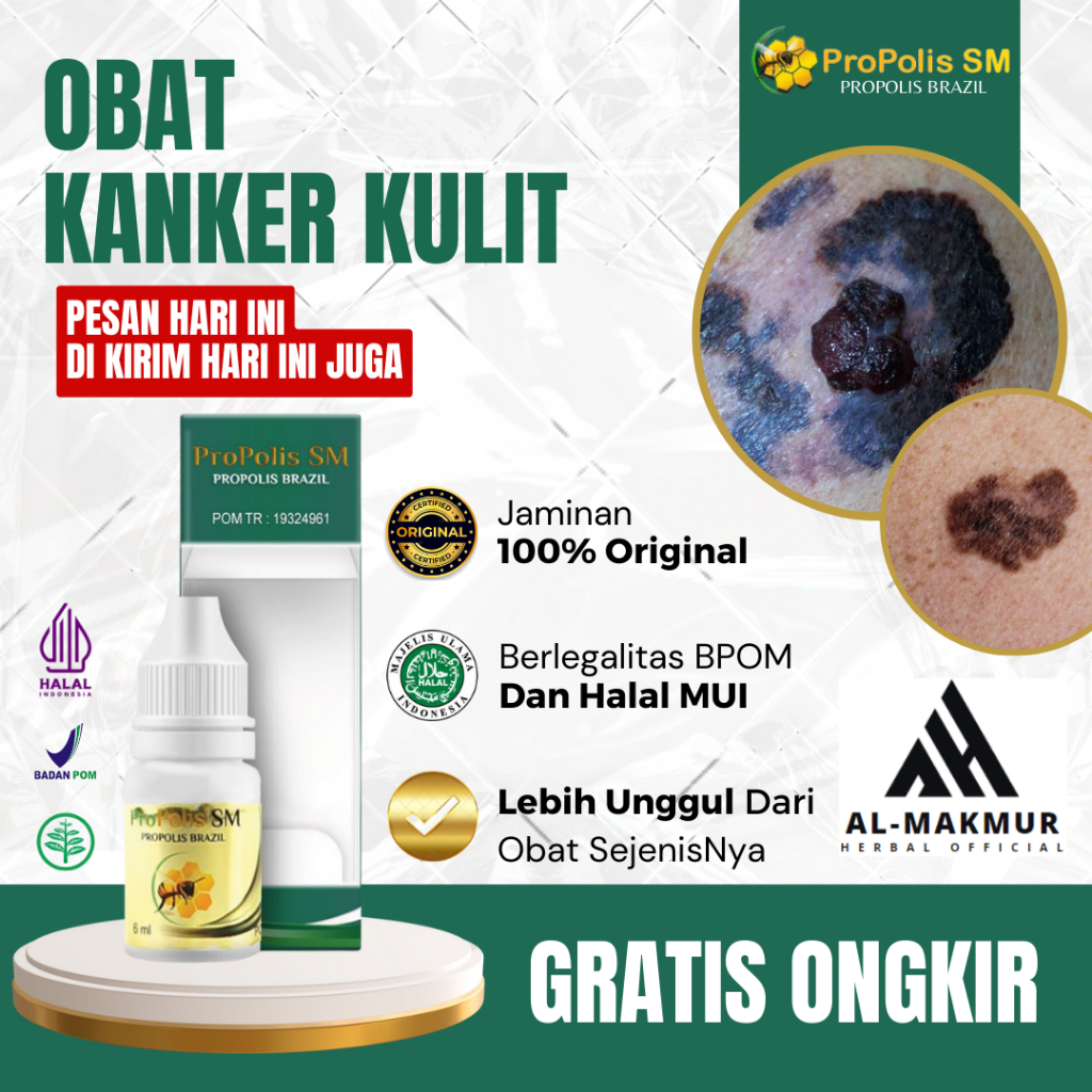 Obat Kanker Kulit, Obat Penghilang Bercak Hitam Di Kulit, Obat Kanker Kulit Melanoma, Obat Penghilan