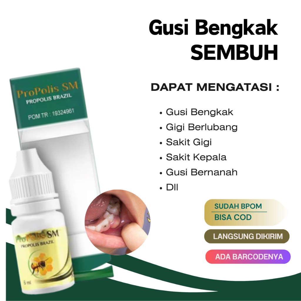 Propolis Sm Brazilian Obat Gusi Bengkak Bernanah