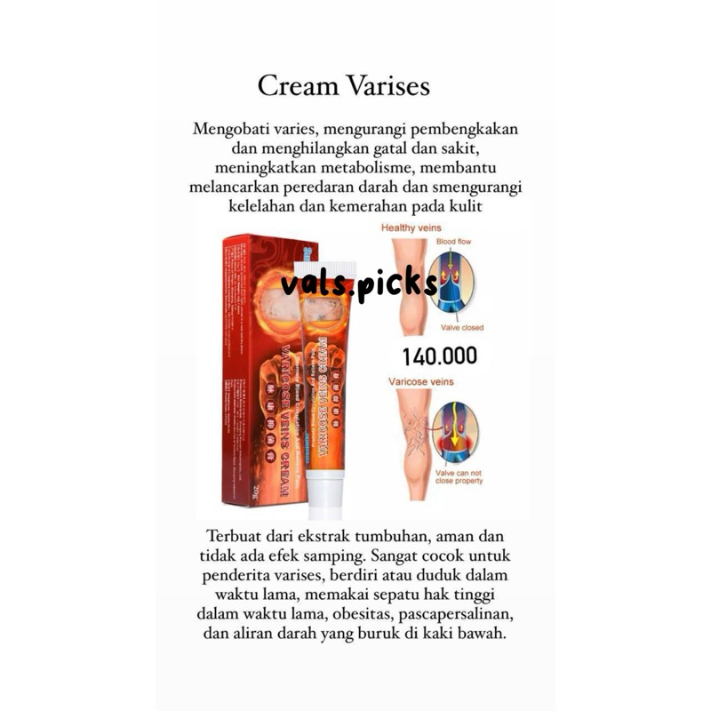 Cream Varises