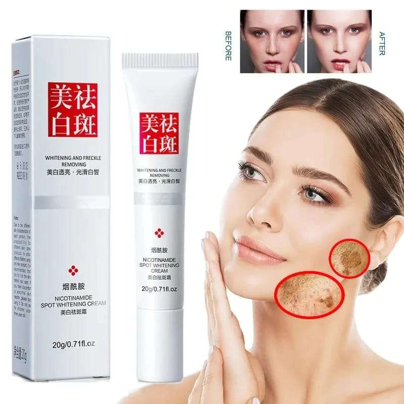 FUYAN Nicotinamide Spot Whitening Cream Penghilang Flek/Jerawat/Bintik Noda Hitam/Komedo|CREAM FLEK 