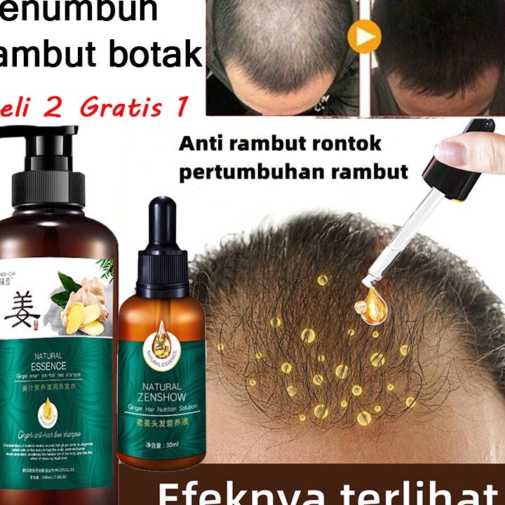 penyubur rambut pria Shampo Penumbuh Rambut Cepat Serum Rambut Rontok Botak Rontok Penumbuh Rambut P
