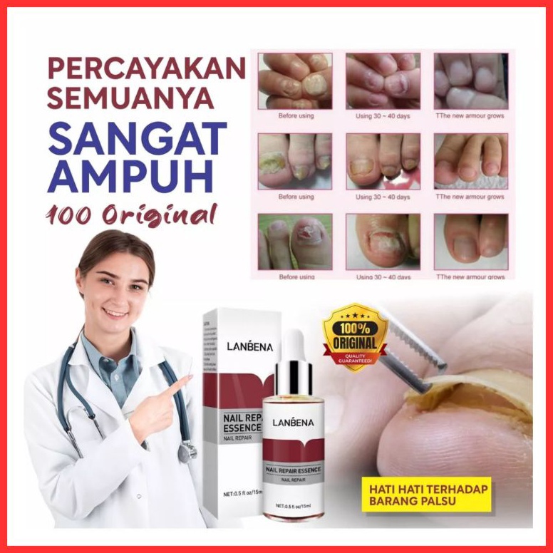 ART W38T BPOM LANBENA NAIL REPAIR ESSENCE SERUM JAMUR KUKU PERAWATAN KUKU OBAT KUKU PERBAIKAN KUKU R