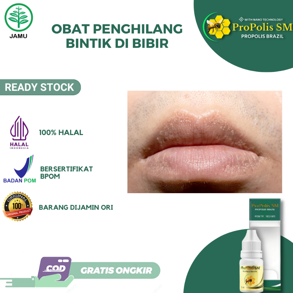 Obat Penghilang Bintik di Bibir Fordyce Spots Sariawan Alergi Herpes Simpleks Milia Bintik Putih di 