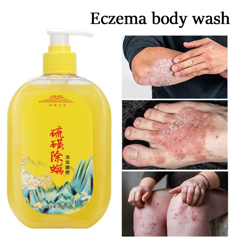 sabun penghilang jerawat punggung sabun jerawat punggun acne body wash sabun jerawat back acne body 