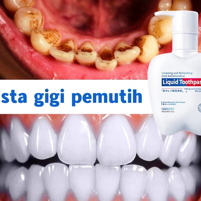 KI3 READY STOCKPasta Gigi Pemutih Odol Pemutih Gigi dan Penghilang Karang Gigi Pencegah Gigi Berluba