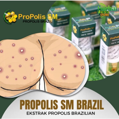 Obat Penghilang Gatel - Gatal Bruntus & Hitam di Pantat, Pembersih Bekas Koreng di Bokong | Pantat P