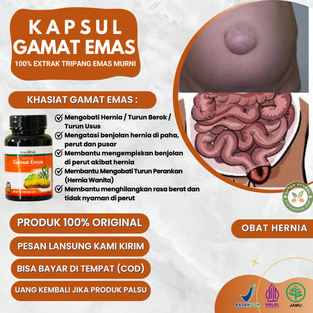 Kapsul Gamat Emas - Obat Hernia, Hernia inguinalis, Hernia femoralis, Hernia umbilikus, Turun Berok,
