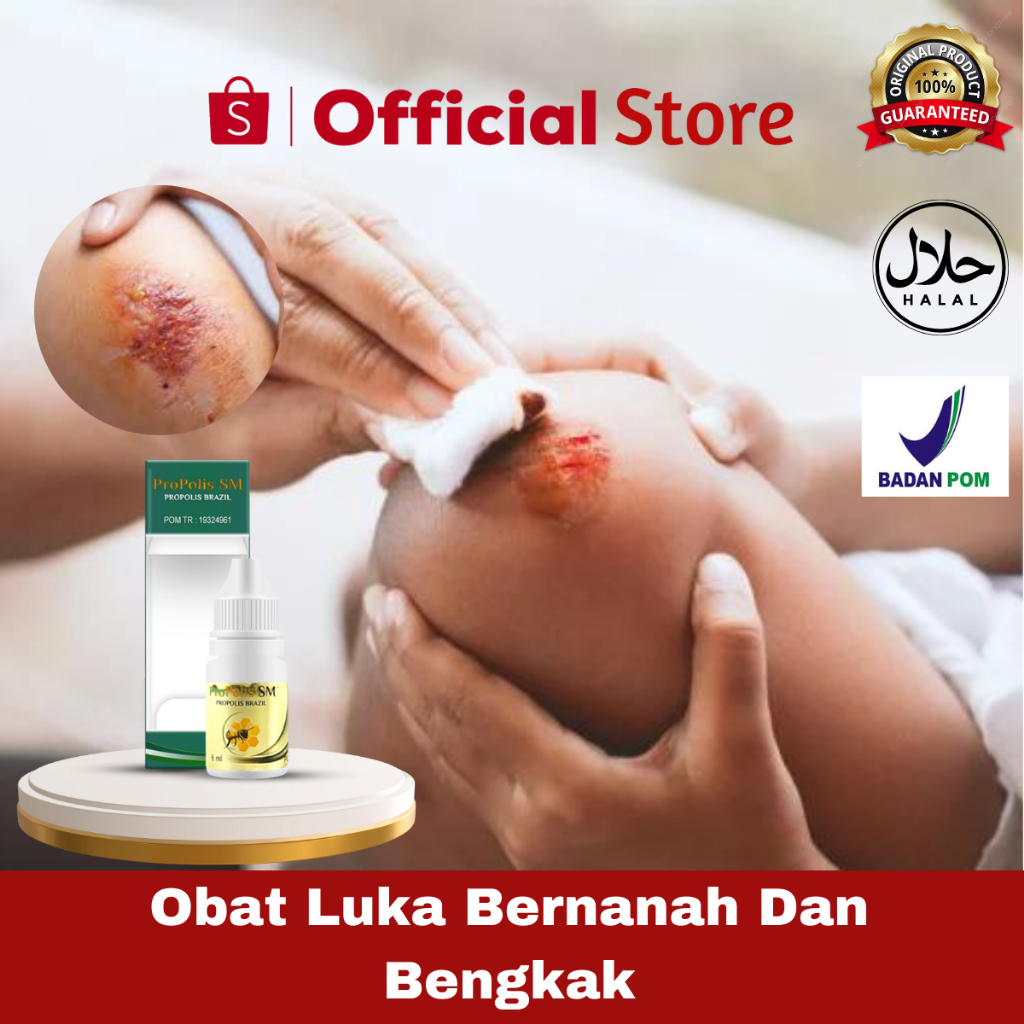 Obat Luka Bernanah Dan Bengkak, Luka Diabetes, Obat Luka Basah Sobek, Luka Pasca Operasi, Penegering