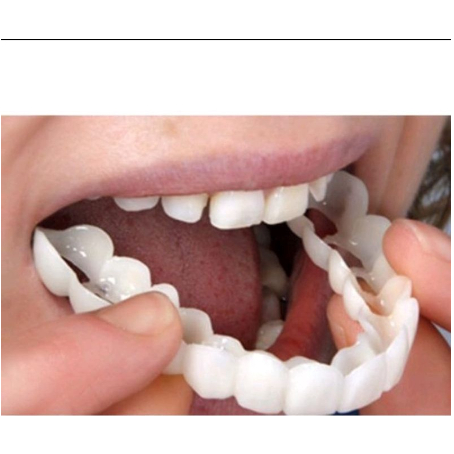 SMILE GIGI PALSU ATAS BAWAH GIGI PALSU LEPAS PASANG VENEER snap on smile