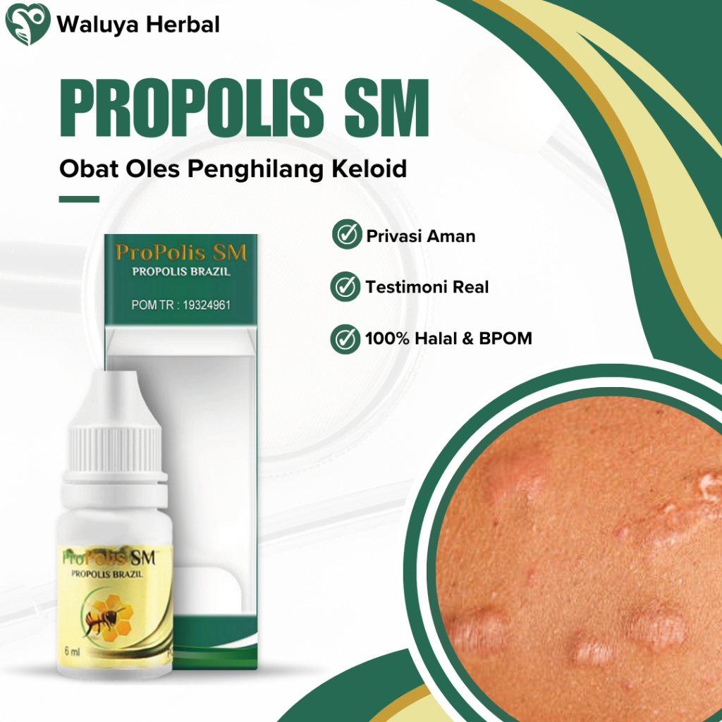 Obat oles Penghilang Keloid Daging Tumbuh, Penghilang Luka Tindik, Penghilang Stretch Mark Garis Hit