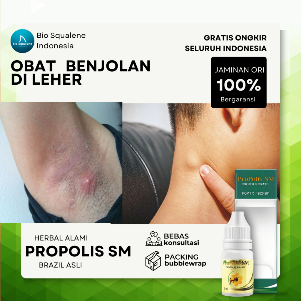 Obat Kelenjar Getah Bening Benjolan Di Leher Kelenjar Tiroid Lipoma Gondok Pada Anak Dan Dewasa Benj