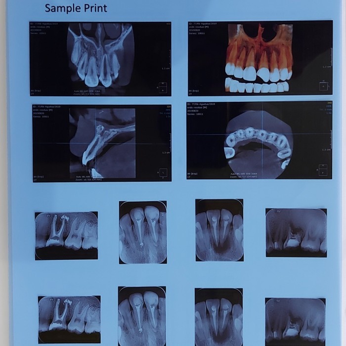 

Medical Blue Film for Inkjet Printer/ Dry Medical X ray Film